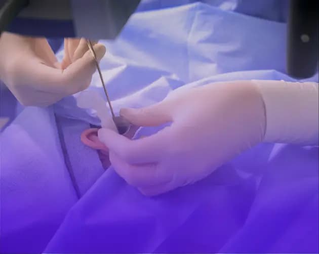 4K Surgical Operating Microscope being used in ENT Surgery