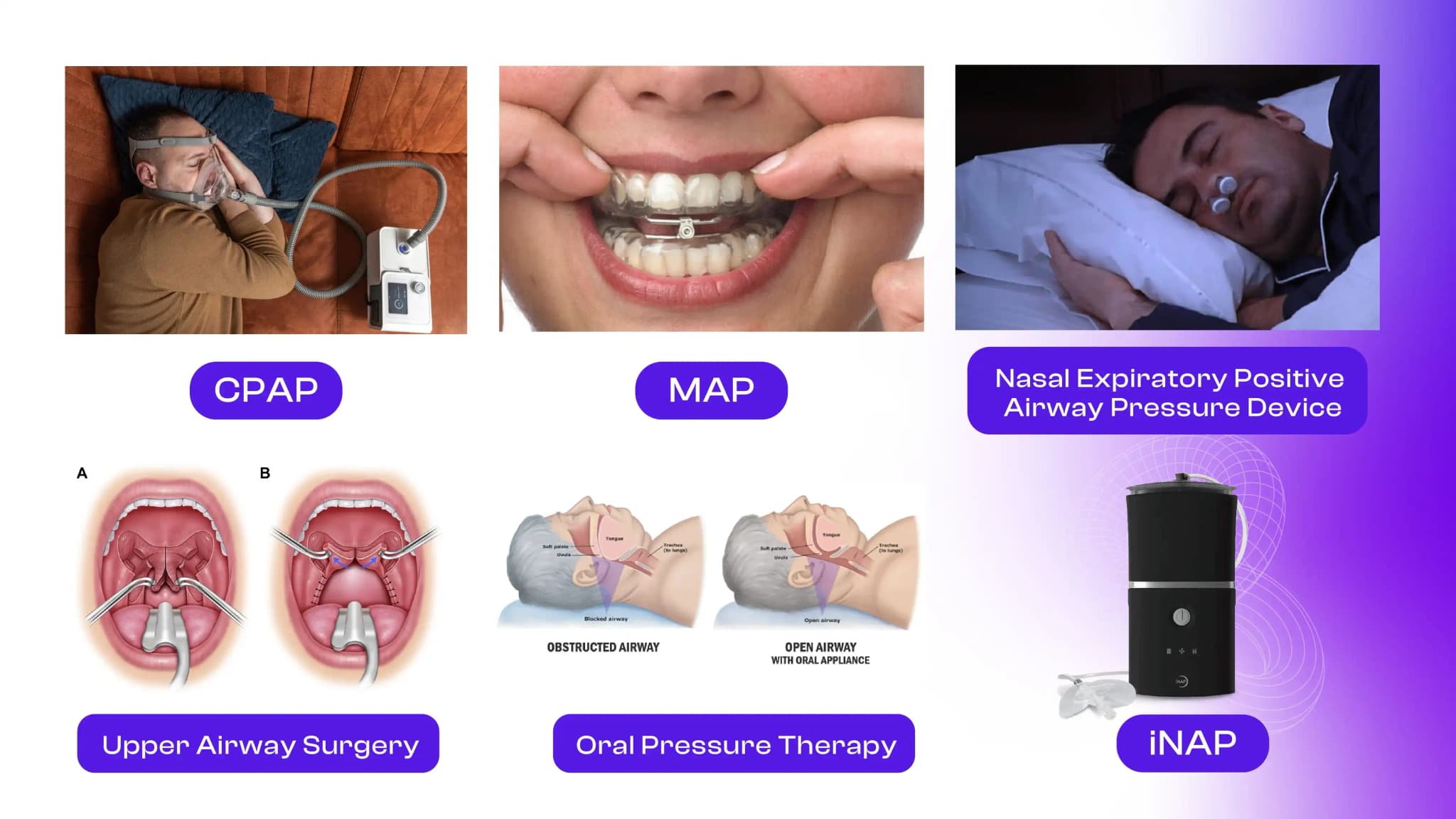 Sleep Apnea Simplified: Causes, Risks, and Modern Treatments