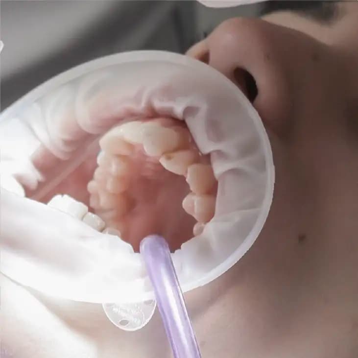 Taevas Origins 4K Surgical Microscope — Laryngeal / Airway Procedures