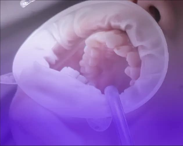Taevas Origins Surgical Operating Microscope for Laryngeal Microsurgery in Thailand