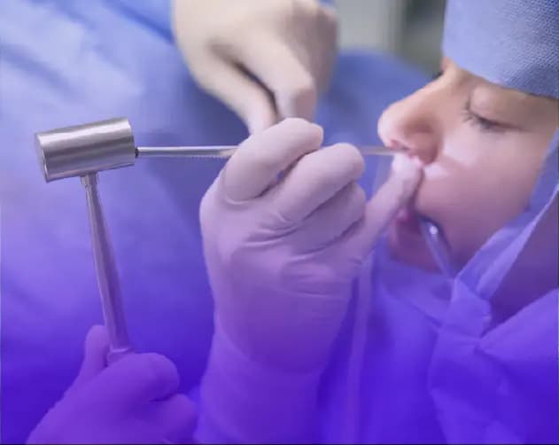 Surgical Microscope for Nasal & Sinus Procedures in Thailand