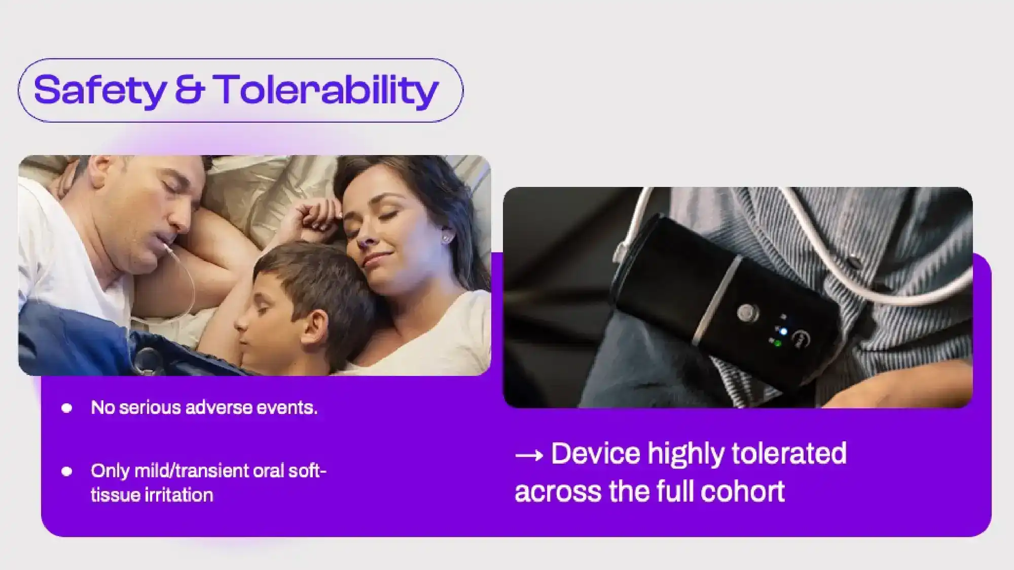 Oral Pressure Therapy: A Promising Emerging Option for OSA Management