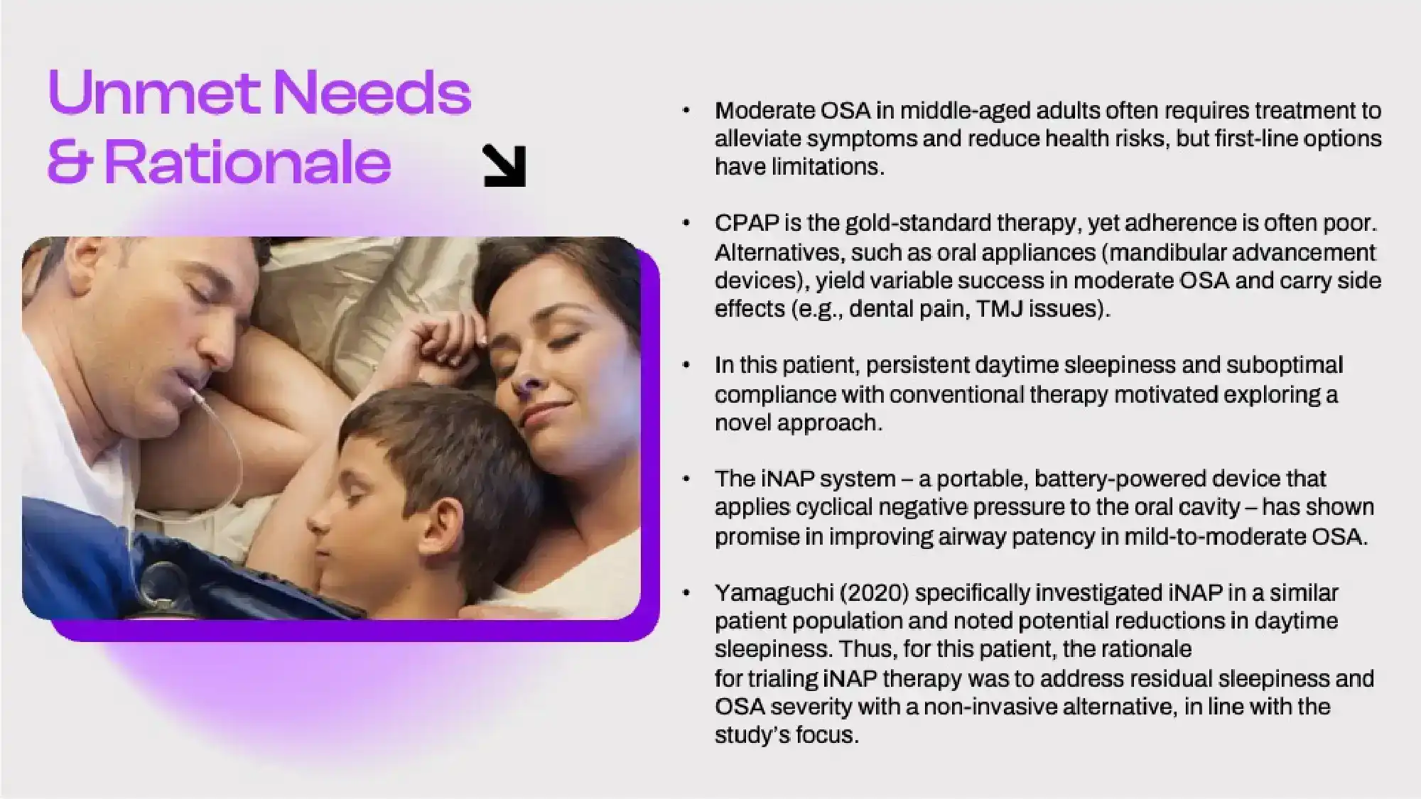 iNAP Therapy in a Middle-Aged Male with Moderate OSA