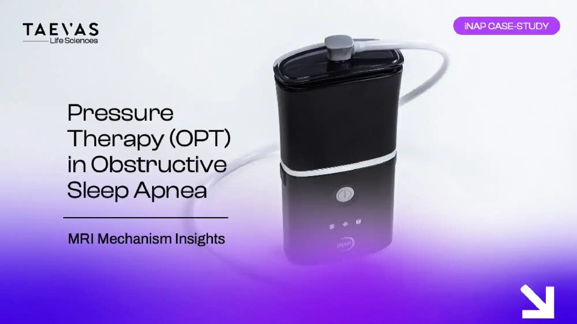 Oral Pressure Therapy (OPT) in Obstructive Sleep Apnea