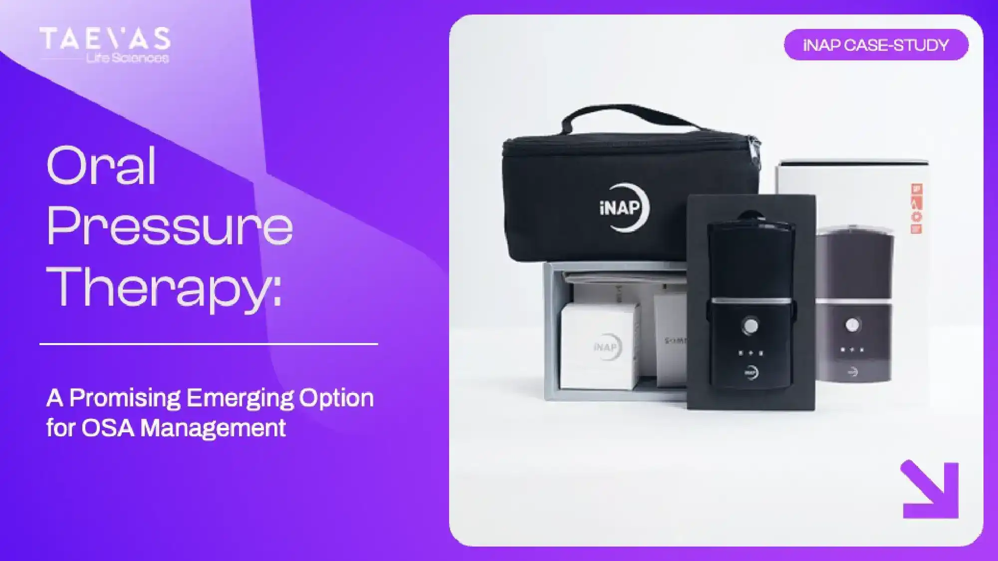 Oral Pressure Therapy: A Promising Emerging Option for OSA Management