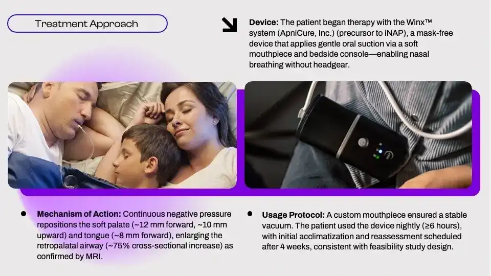 CPAP-Reluctant Patient Achieves OSA Control With INAP