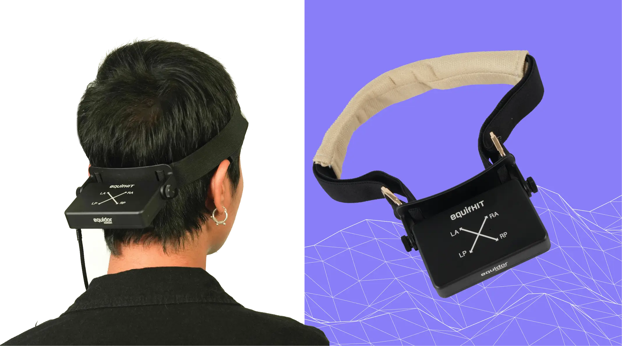 Why Is Peripheral vs Central Vertigo Not the Best Diagnostic Approach?